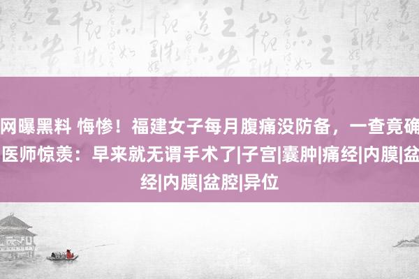 网曝黑料 悔惨！福建女子每月腹痛没防备，一查竟确诊……医师惊羡：早来就无谓手术了|子宫|囊肿|痛经|内膜|盆腔|异位